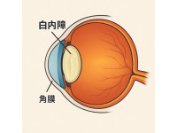 看得清  活得好 白內障手術新趨勢與人工水晶體選擇指南